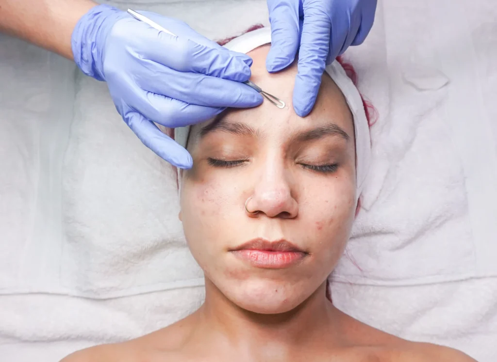 I Am a College Student. Are La Roche-Posay Products Better for Acne-Prone Skin Than Neutrogena?
